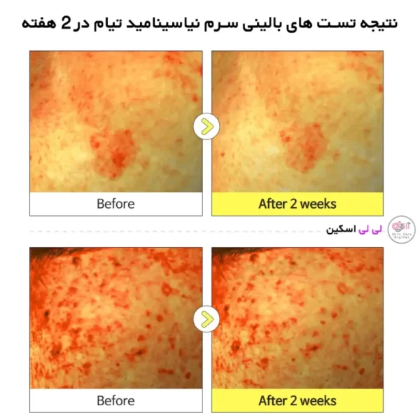 سرم ضد لک نیاسینامید تیام حجم 40 میلی لیتر